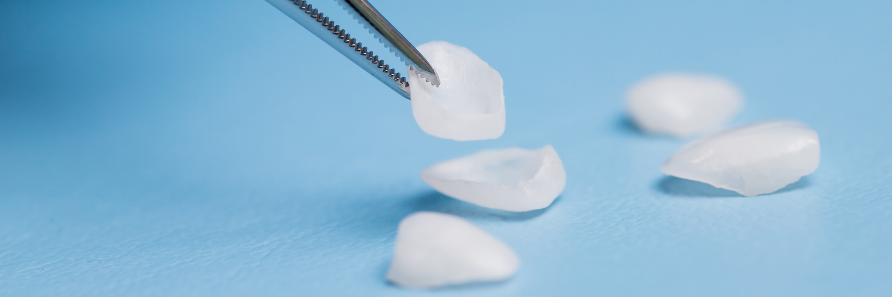 Porcelain Veneers | Dentist